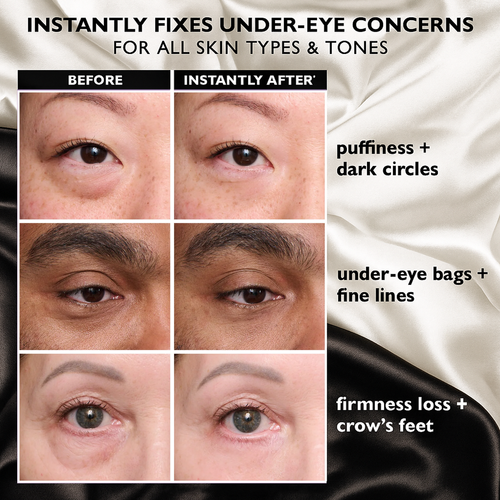 Peter Thomas Roth: Instant FIRMx Temporary Eye Tightener