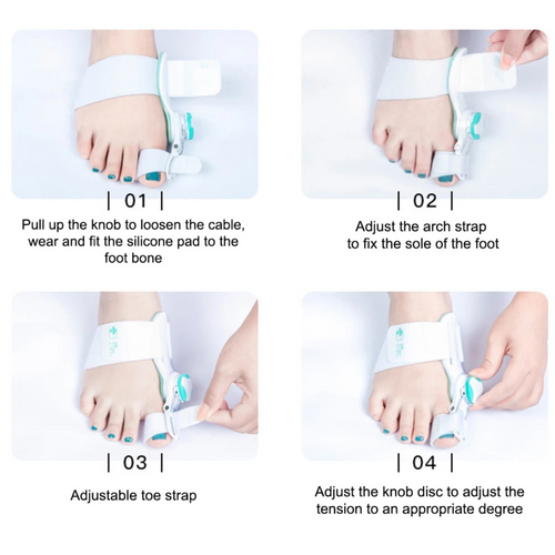 Novella™ Clinical Grade Toe Realignment & Correction System