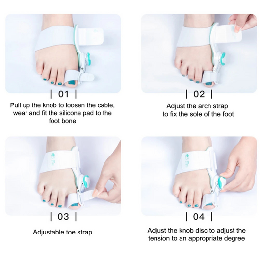 Novella™ Clinical Grade Toe Realignment & Correction System