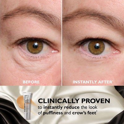 Peter Thomas Roth: Instant FIRMx Temporary Eye Tightener
