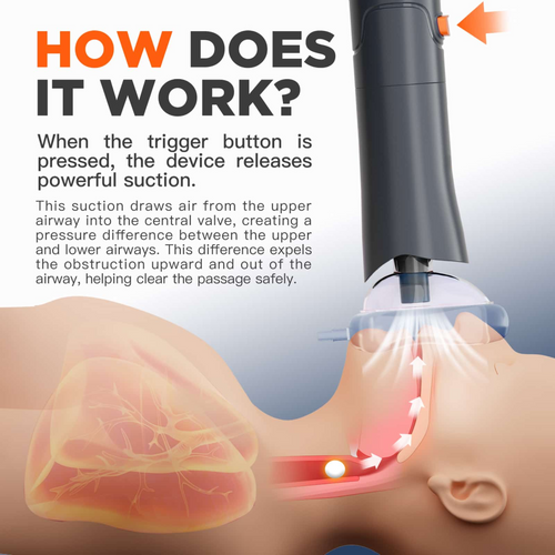 Novella™ Professional Life-Saving Choking Emergency Response Unit
