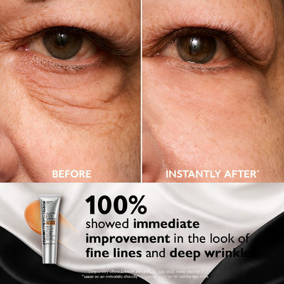 Peter Thomas Roth: Instant FIRMx Temporary Eye Tightener