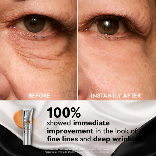 Peter Thomas Roth: Instant FIRMx Temporary Eye Tightener