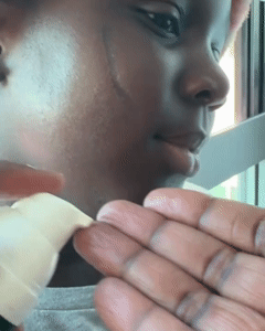 STOP Letting Old Scars Define You