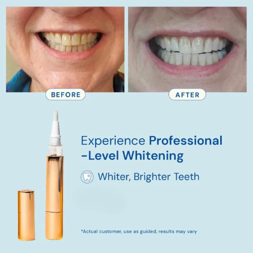 Novella™ Clinical Grade Whitening Pen