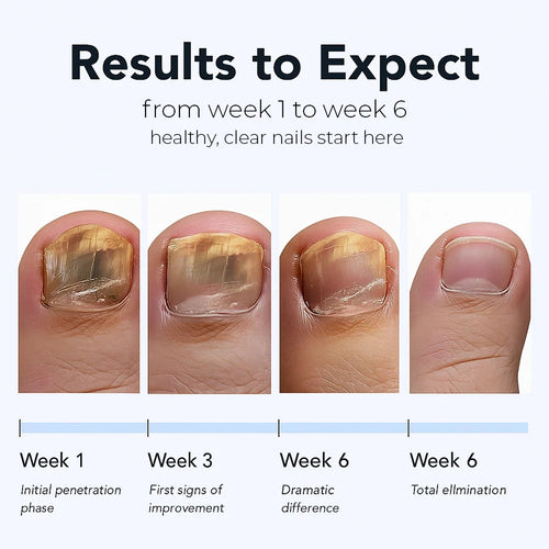 Novella™ Fungal Nail Renewal Patches